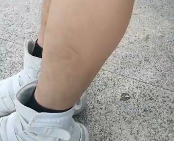 眉清目秀的妹纸：每个人的身上都有毛毛